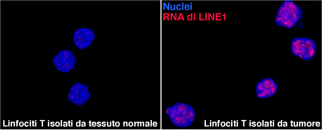 Il “DNA spazzatura” è in grado di attivare la risposta immunitaria dei linfociti T, le sentinelle della lotta ai tumori